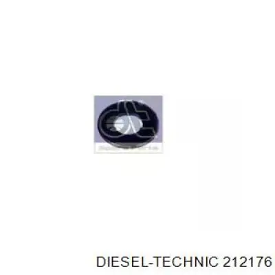 212176 Diesel Technic