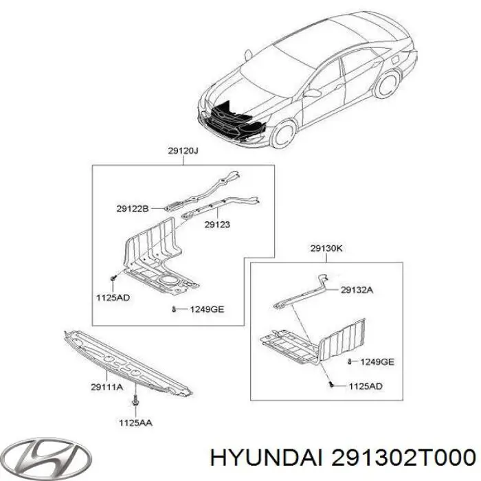 Protector de motor izquierdo para Hyundai Sonata (YF)
