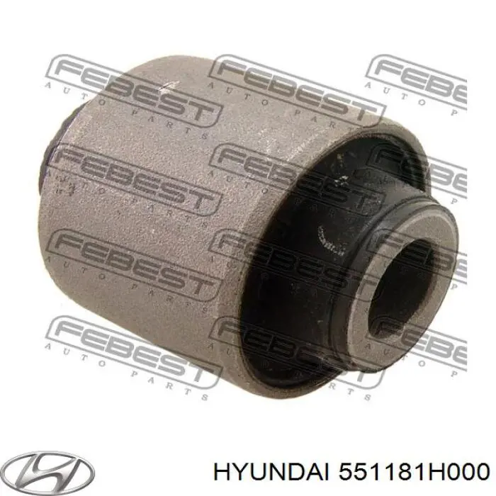 Silentblock del brazo superior de suspensión trasera Hyundai/Kia 551181H000 precio, desde 8,76 EUR