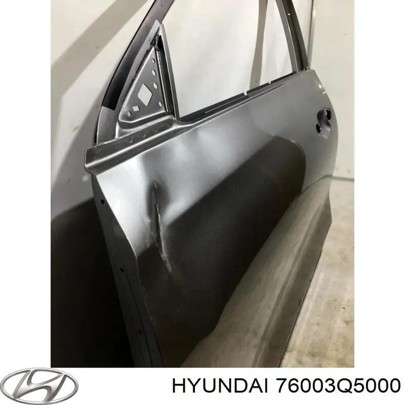 76003Q5000 Hyundai/Kia