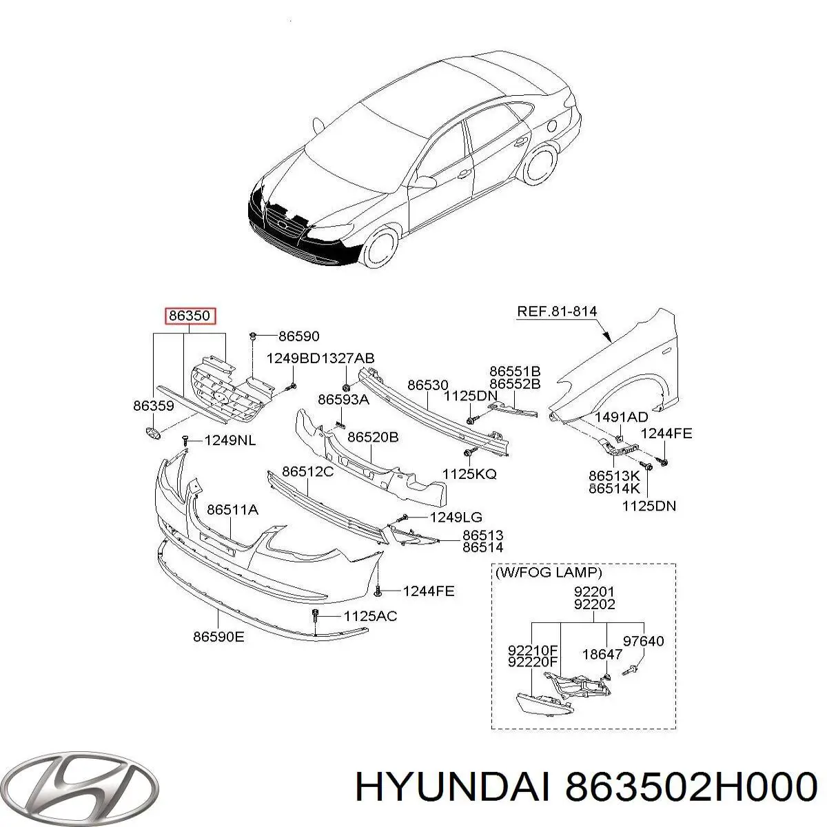 Calandra para Hyundai Elantra IV HD