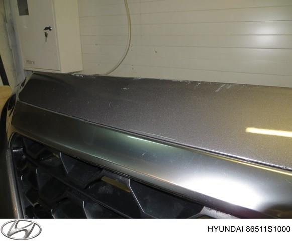 86374S1000 Hyundai/Kia Moldura superior de la parrilla del radiador