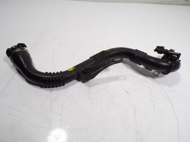 Abrazadera de tubo del intercooler FT96407 Fast